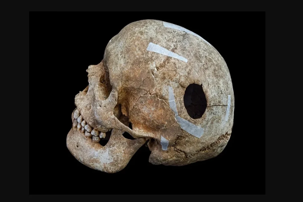 IX əsrə aid kütləvi məzarda “nəhəng” skelet aşkarlandı 